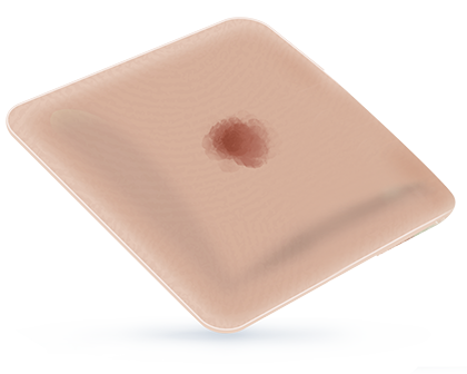 25% EXUDATE FOAM COVERAGE