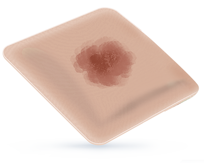 75% EXUDATE FOAM COVERAGE