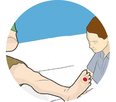 Neuropathic/Diabetic Ulcer